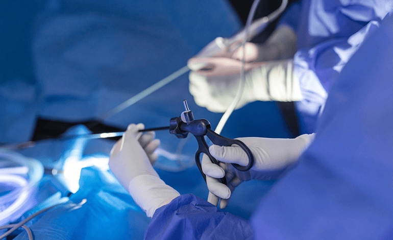 Plastia inguinal